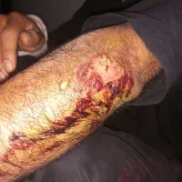 در مورد تصادف میخاستم سوال کنم