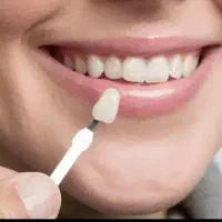 خدمات دندانپزشکی با تعرفه دولتی