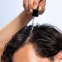 فرصتی برای احیای موهای از دسترفته