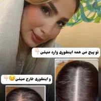 دیگه نیاز نیست کاشت انجام بدی