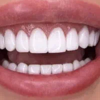 آموزش کامپوزیت