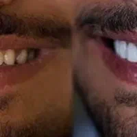 لبخنده زیبا