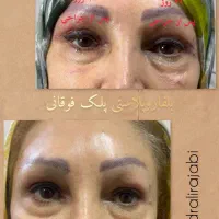 بوتاکس ژل فیلر چربی بلفاروپلاستی مزو PRP نخ لیزر|خدمات آرایشگری و زیبایی|شاهین‌شهر, فردوسی|دیوار