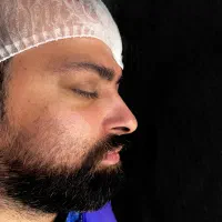 تیپ پلاستی ۱۶ بدون بیهوشی|خدمات آرایشگری و زیبایی|تهران, آسمان|دیوار