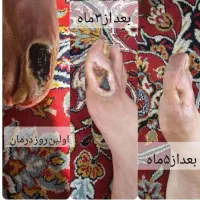 مزاج شناسی و پاکسازی|آرایشی، بهداشتی، درمانی|اهواز, امانیه|دیوار