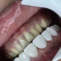 دندانپزشکی با پایین ترین قیمت و بالاترین کیفیت|خدمات آرایشگری و زیبایی|کرمانشاه, |دیوار
