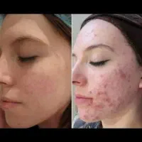 لیزر/هایفو/فیشیال/ژل و بوتاکس/جراحی های سرپایی