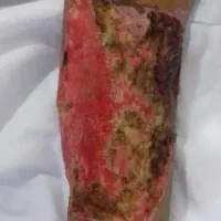 خدمات پرستاری درمنزل.تزریقات.وصل سرم کل اهواز|خدمات زیبایی و سلامت|اهواز, کیانپارس |دیوار