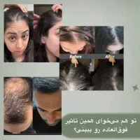مشاور محصولات مراقبتی پوست و مو