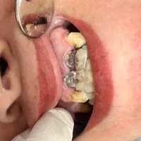 خدمات دندانپزشکی  با  قیمت و شرایط پرداخت عالی|خدمات آرایشگری و زیبایی|رشت, دروازه لاکان|دیوار