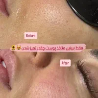 فیشیال حرفه ای بانوان تخفیف