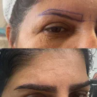میکروکاشت