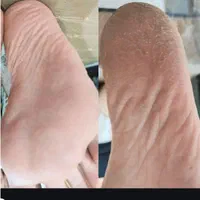 پدیکورتخصصی.وکف سابی و پارافین تراپی|خدمات آرایشگری و زیبایی|ارومیه, |دیوار