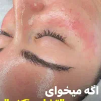 پاکسازی پوست با بهترین متریال و کمترین هزینه|خدمات آرایشگری و زیبایی|آبادان, |دیوار