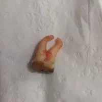 کشیدن دندان های خوی و سلماس|خدمات آرایشگری و زیبایی|خوی, |دیوار