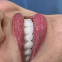 خدمات دندان پزشکی لبخند سفید