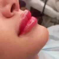 شیدلب.ابرو.کانتور