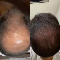 هنوزم فکر میکنی کاشت تنها راهه