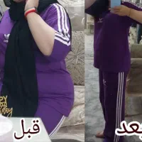 درمان چاقی|آرایشی، بهداشتی، درمانی|کوهدشت, |دیوار