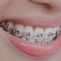 ارتودنسی تخصصی