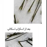 افر ویژه خدمات اسکراب کف سر-درمانی ۲.۵۰۰ تومان|خدمات آرایشگری و زیبایی|کیش, |دیوار