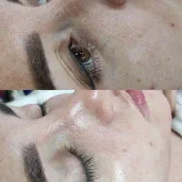 فیشال و پاکسازی پوست|خدمات آرایشگری و زیبایی|محمدشهر, محمدشهر|دیوار