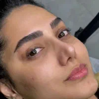 میکروبلیدینگ و فیبروز صورت بدون درد و خونریزی|خدمات آرایشگری و زیبایی|گلبهار, شهر جدید گلبهار|دیوار