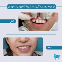 درمانگاه دندانپزشکی مهرشفا با شرایط اقساط|خدمات آرایشگری و زیبایی|قم, حنیف نژاد|دیوار