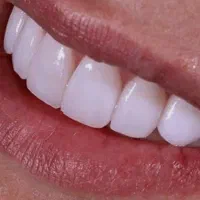 دستیار دندانپزشک