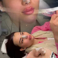 فیلر لب زیر چشم ،لیفت ،عمل بینی