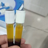 پی آر پی . مزو تراپی .بوتاکس .مزو ژل . هیر فیلر