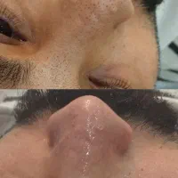 نیازمند مدل پاکسازی و فیشیال پوست فقط هزینه مواد