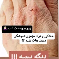 کرم جوانساز پوست دست و صورت|آرایشی، بهداشتی، درمانی|شیراز, بازار|دیوار
