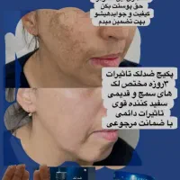کرم دالفورداصل فرانسه ضدلک قوی بارداری وسفیدی پوست|آرایشی، بهداشتی، درمانی|تهران, اتحاد|دیوار