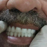 دندان مصنوعی|خدمات آرایشگری و زیبایی|کرج, کوی زنبق|دیوار