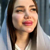 تزریقات ژل ،بوتاکس ،نخ با بهترین قیمت و متریال