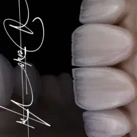 پروتز های ثابت (روکش) دندانسازی لابراتواری