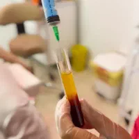 جشنواره تخفیف پی آر پی(PRP)/مزونیدلینگ مو و صورت|خدمات آرایشگری و زیبایی|اصفهان, باغ زرشک|دیوار