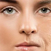 استخدام پزشک عمومی ویا متخصص پوست