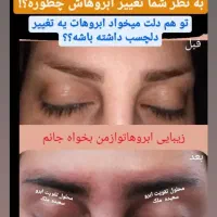 محلول رویش و رشد مجدد ابرو و مژه ملک