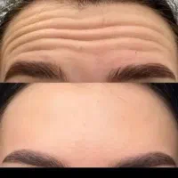 پرسینگ همه بدن 180|بدلیجات|اهواز, حصیرآباد|دیوار