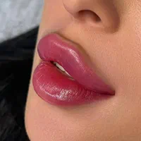 مدل ژل و بوتاکس و فیلر و مزو آنزیم