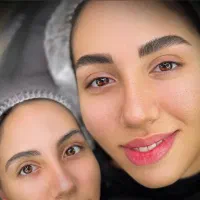 مدل برای میکروبلیدینگ نچرال بروز(هزینه مواد)فوری