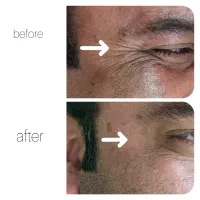 انجام کلیه خدمات زیبایی توسط پزشک در کلینیک در فسا|خدمات آرایشگری و زیبایی|فسا, |دیوار