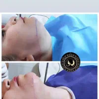 خدمات پوست و زیبایی مجاز|خدمات آرایشگری و زیبایی|شیراز, چوگیاه|دیوار