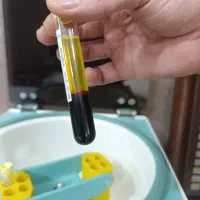 کاشت مو و خدمات مرتبط