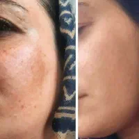 ازبین برنده لک