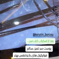 اسکالپ سر،پروتئین‌تراپی،کراتین و..|خدمات آرایشگری و زیبایی|مشهد, خواجه ربیع|دیوار