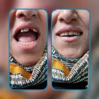 دندانپزشکی،دندانسازی|خدمات آرایشگری و زیبایی|دشتابی, |دیوار