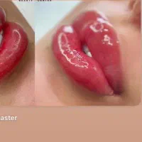 کار میکرو بلیدیینگ ،شیدینگ لب خط چشم دائم